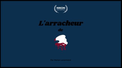 L'arracheur de dents