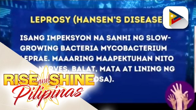 SAY NI DOK: Sanhi, sintomas, at paano nagagamot ang sakit na ketong o leprosy