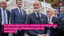 Edouard Philippe métamorphosé : cette nouvelle apparence due à ses deux maladies auto-immunes