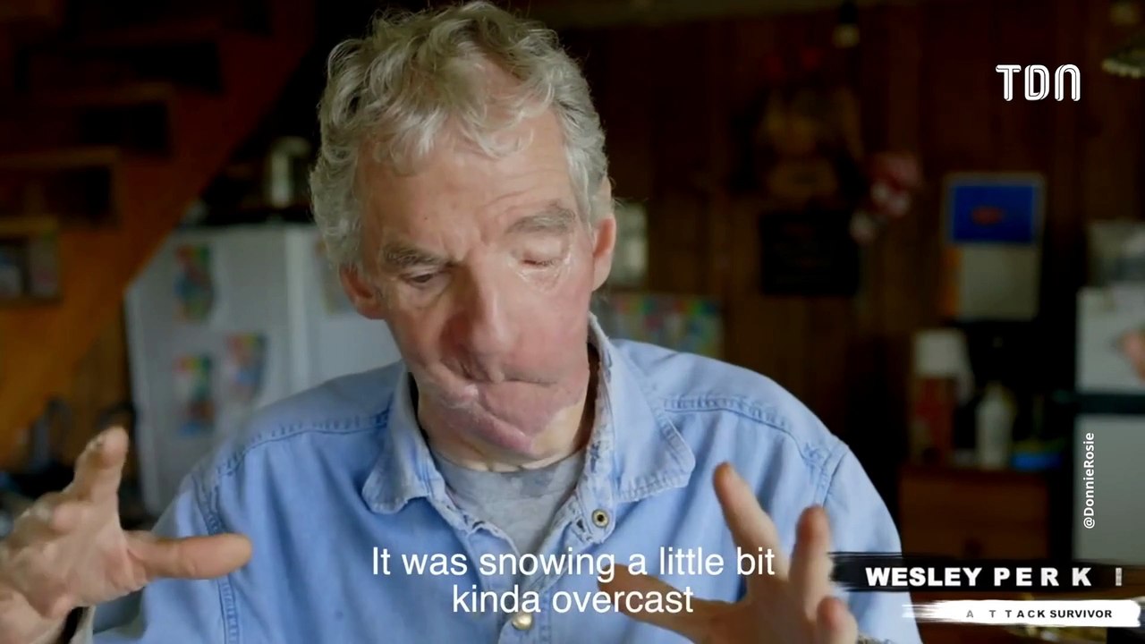 "Dents, langue et mâchoire arrachés" : un homme sauvagement attaqué par un ours (Vidéo)