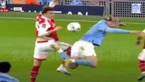 Manchester City Striker Erling Haaland Terrible Bicycle Kick Injury Vs Arsenal