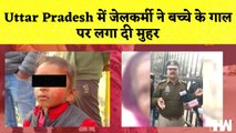 Uttar Pradesh में जेलकर्मी ने बच्चे के गाल पर लगा दी मुहर| Lakhimpur| UP Police | Jail | Assault