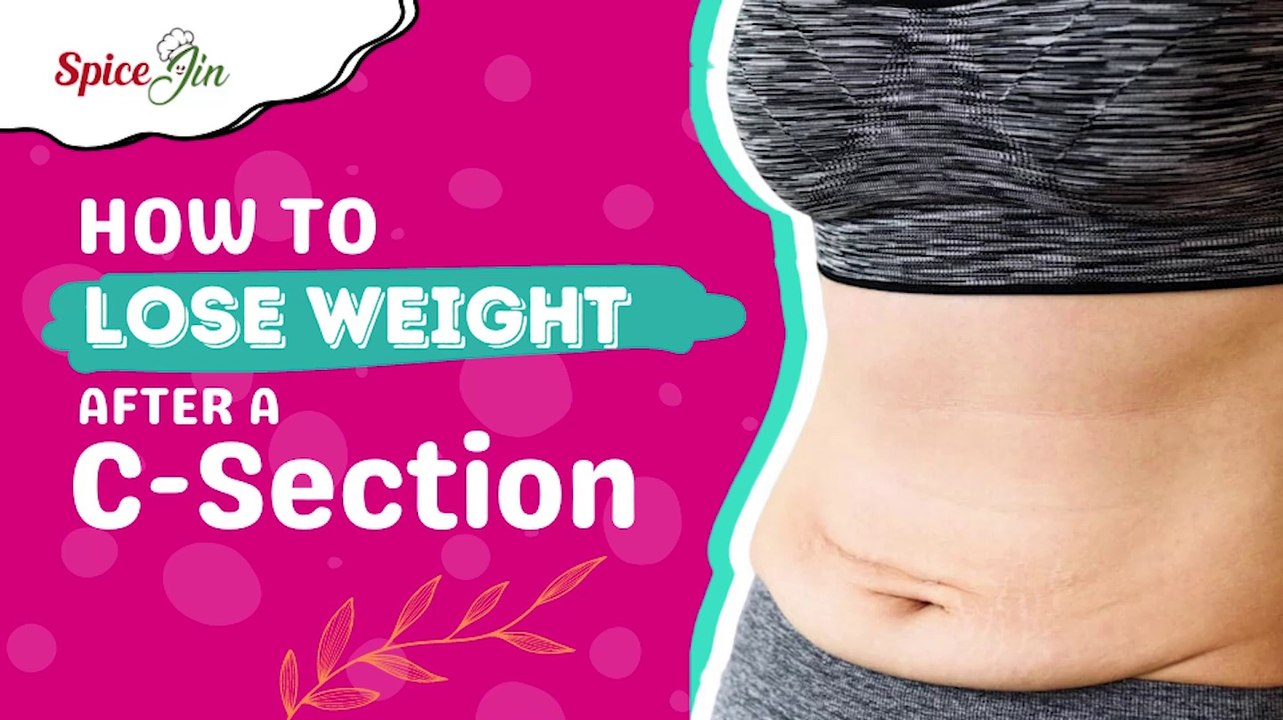 How to lose weight after a C section video Dailymotion