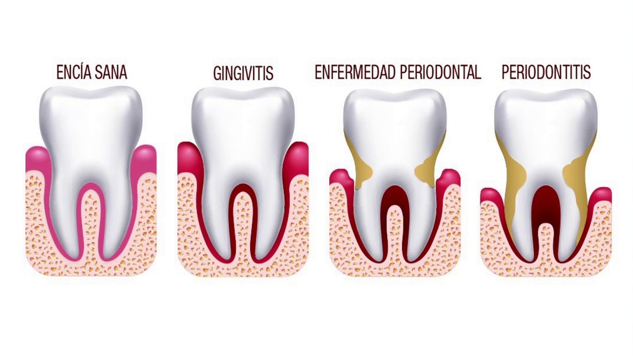 bd-problemas-dentales-comunes-en-adultos-mayores-300123