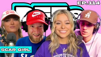 SCAR GIRL REVEALS ALL — BFFs EP. 114
