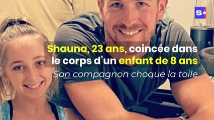 Shauna, 23 ans, coincée dans le corps d’un enfant de 8 ans : voici pourquoi son nouveau compagnon choque la toile