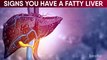 11 WARNING Signs Of Fatty Liver Nobody Ever Told You