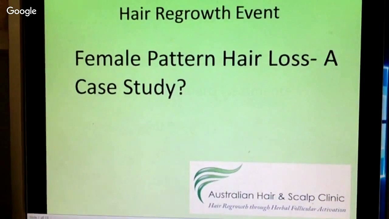 Case Study for Female Pattern Hair Loss