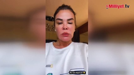 'Önce minibüs çarptı, sonra uçağıma yıldırım düştü! Bu sabah da böyle uyandım'