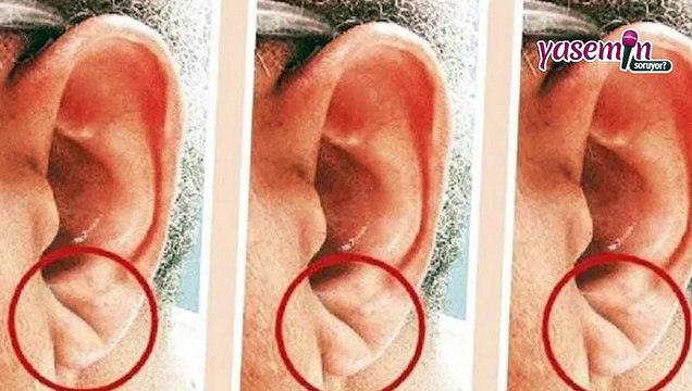 Prof. Dr. Bilal Boztosun anlatıyor! İşaret parmağı uzun olanların kalp krizi geçirme ihtimali yüksek