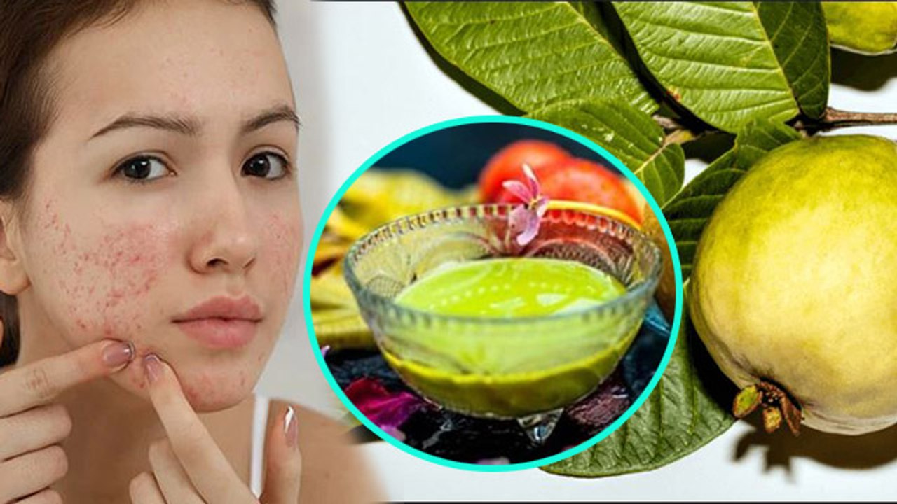 चेहरे पर अमरुद के पत्ते लगाने से क्या होता है | Amrud Ke Patte Chehre Par Lagane Ke Fayde | Boldsky