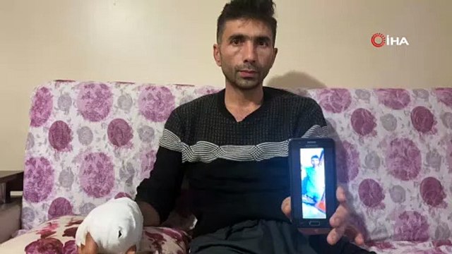 Komşusunun köpeğinin saldırısına uğrayan vatandaşın parmağı koptu, eli parçalandı