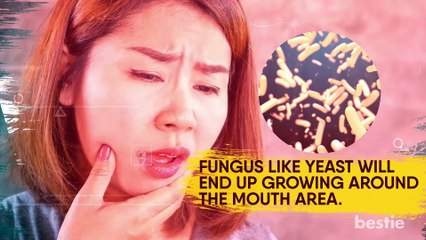 7 Things Your LIPS Can Secretly Reveal About Your Health