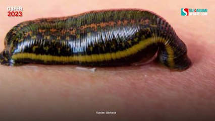 Cewek Ini Tidak Sadar Kalau Hidungnya Kemasukan Lintah