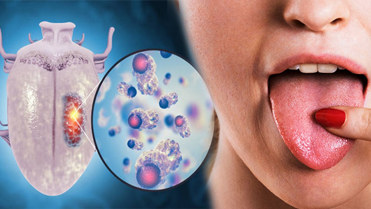 मुंह में कड़वा स्वाद क्यों आता है, मुंह में कड़वा स्वाद आने पर क्या करें |Boldsky