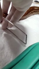 Vídeo mostra exame inédito de endoscopia em cobra em SC