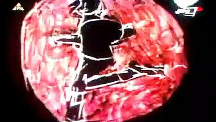 Dziadowski's Blues Non Camera, ie Legs Forward | movie | 1978 | Official Clip