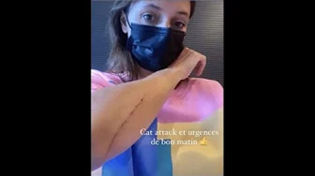 Renaud : sa fille Lolita Séchan "aux urgences"