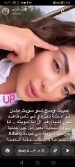 نور الغندور تكشف سبب تغير ملامحها
