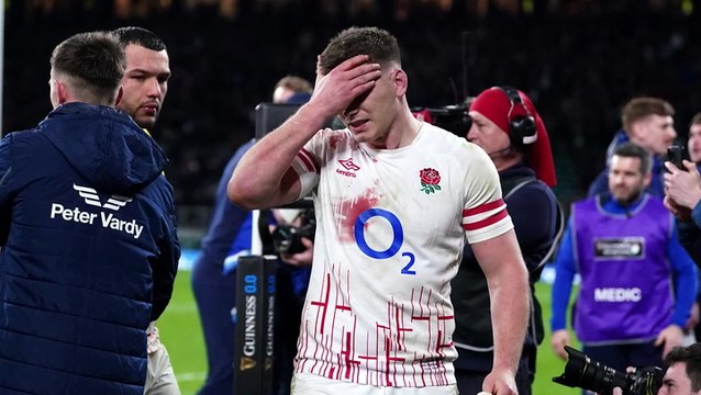 Six Nations: England must endure pain in order to grow, Borthwick says after Scotland loss