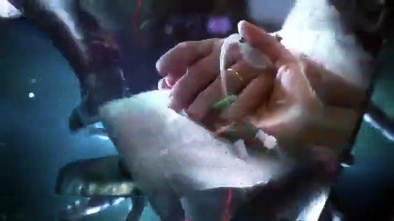 Holby City - Se21 - Ep34 - Where Does It Hurt HD Watch