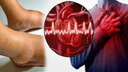 घुटने से पैर के तलवे तक सूजन और दर्द होना इस गंभीर बीमारी का संकेत | Boldsky *health