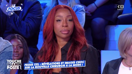 Fesses XXL : cette nouvelle chirurgie qui a la cote !