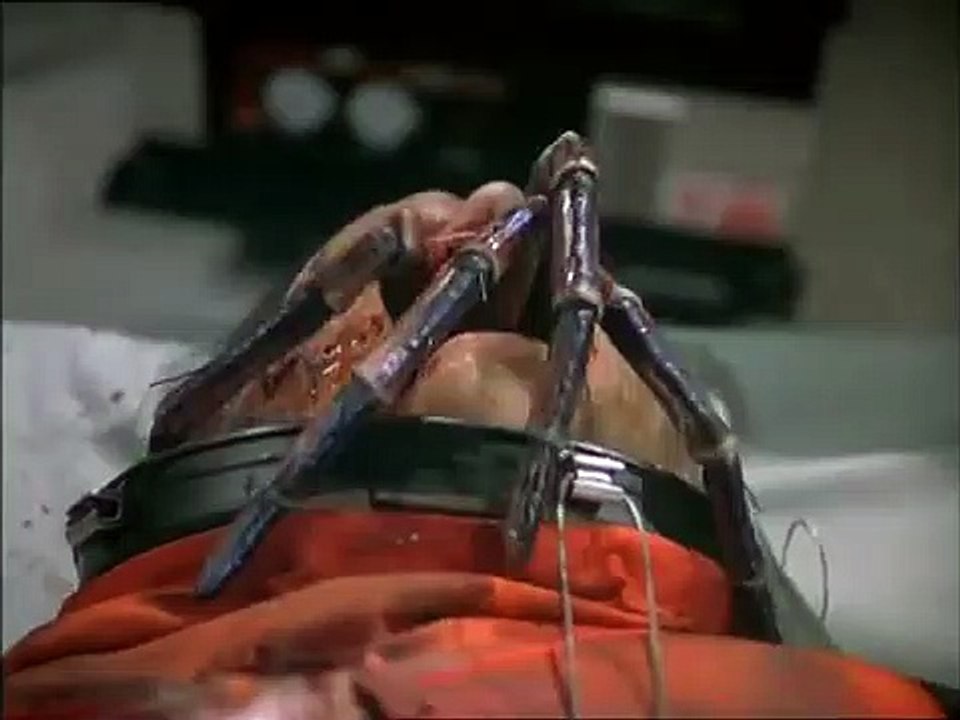 Spider Attack – Achtbeinige Monster | movie | 2000 | Official Trailer