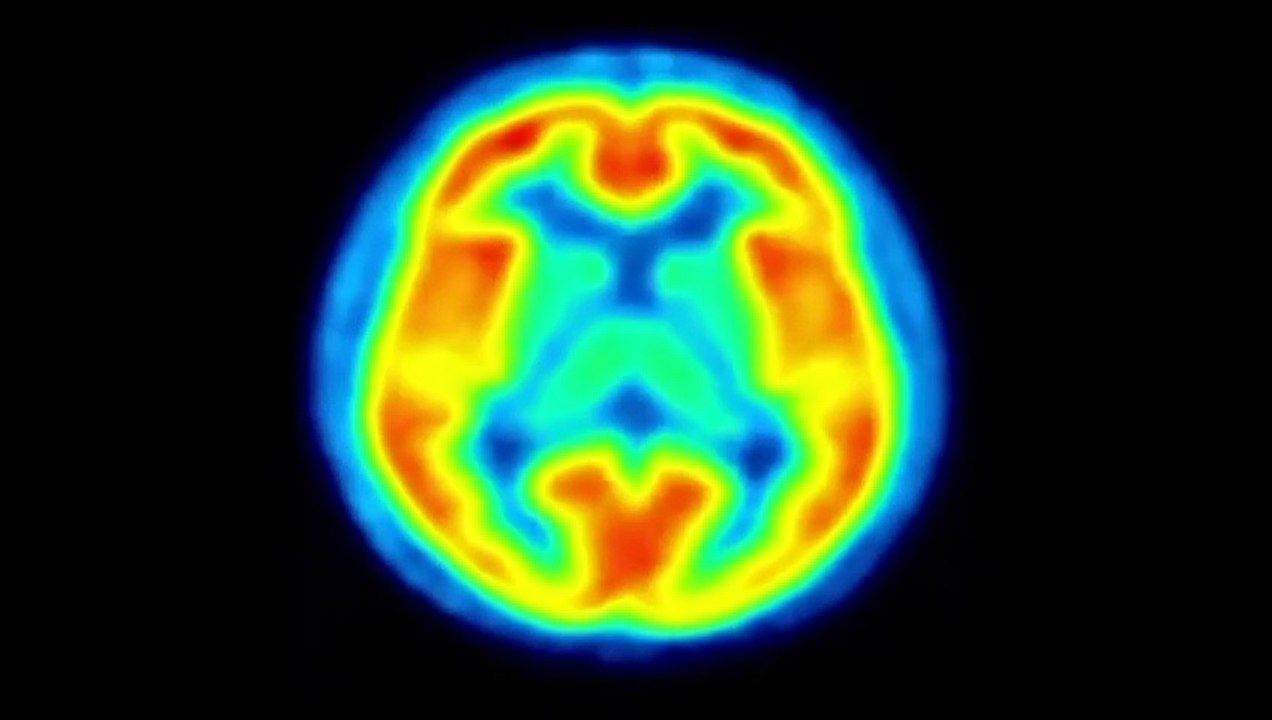 The Substance: Albert Hofmann's LSD | movie | 2012 | Official Trailer