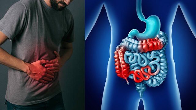 आंतो में सूजन क्यों होती है । आंतो में सूजन के कारण । Boldsky