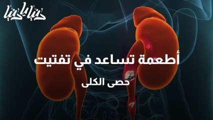 أطعمة تساعد في تفتيت حصى الكلى