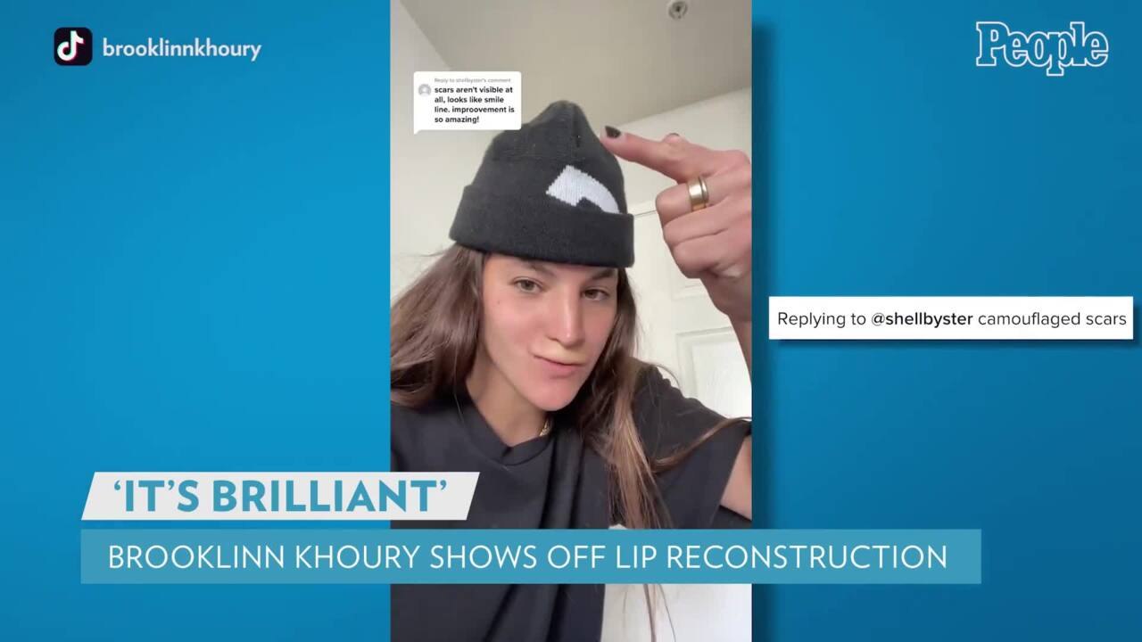 Brooklinn Khoury Shares Progression of Her Lip Reconstruction: 'My Face Gradually Starts Looking Better'