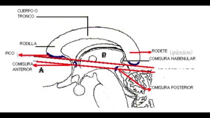 PROTOCOLO BASICO DE CRANEO EN RESONANCIA MAGNETICA