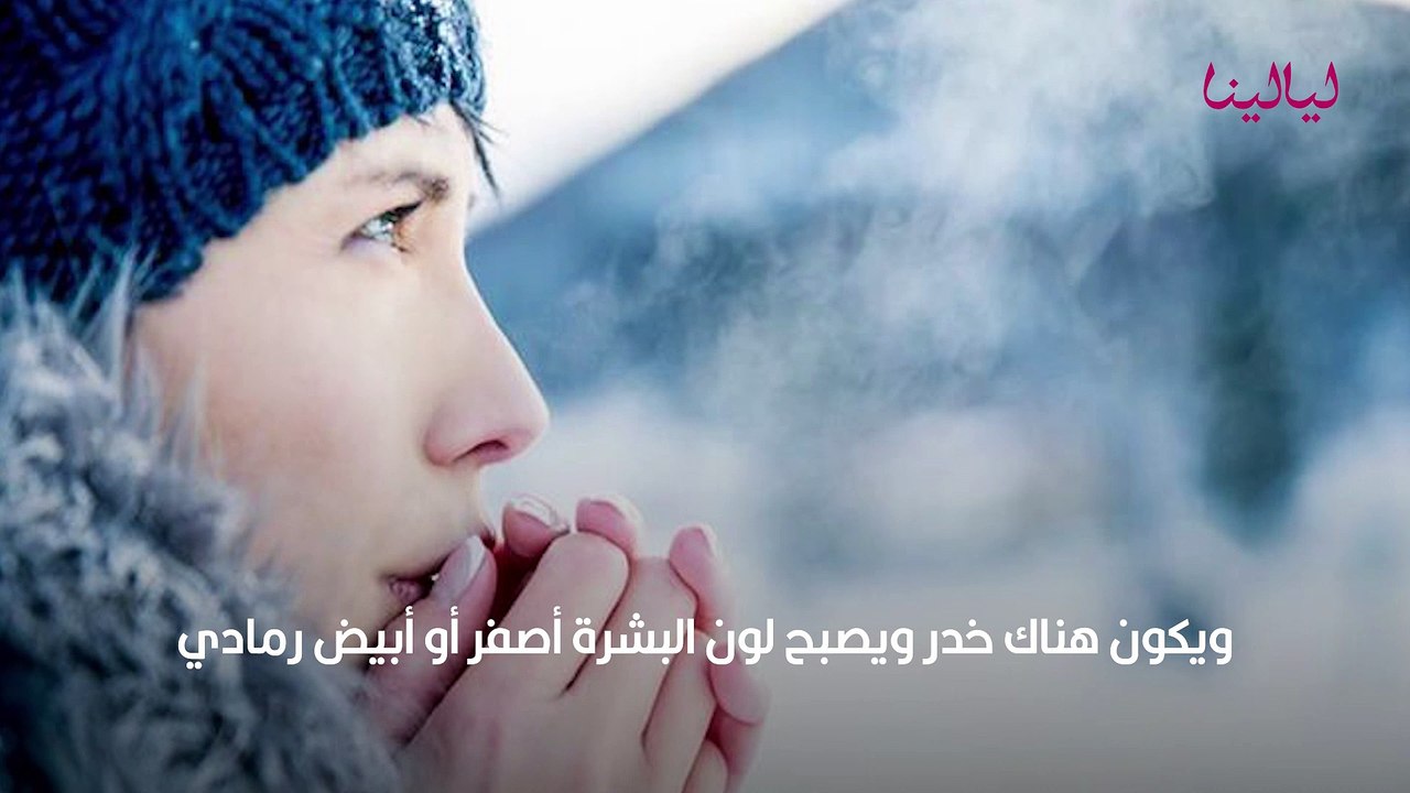 تورم الأصابع في فصل الشتاء