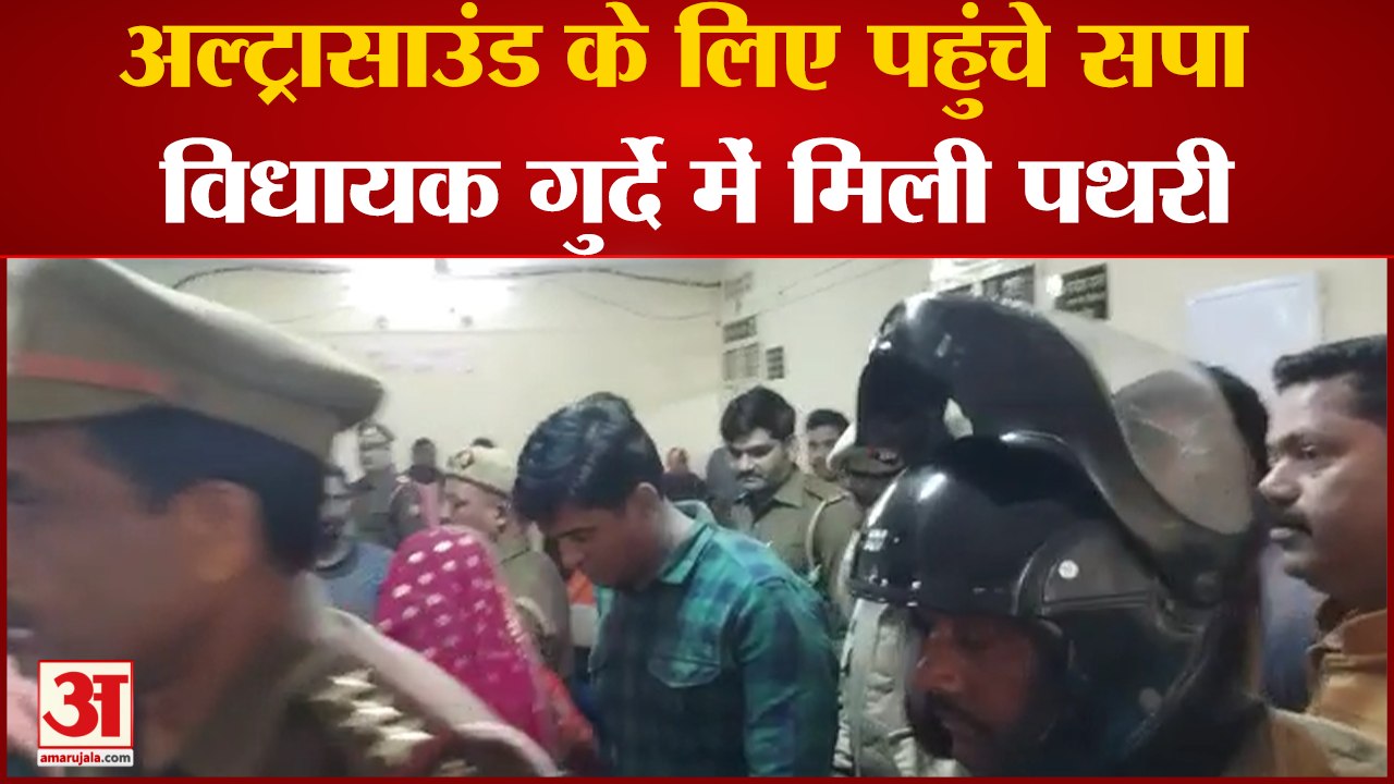 Irfan Solanki : अल्ट्रासाउंड के ‌लिए पहुंचे सपा विधायक इरफान सोलंकी, गुर्दे में मिली पथरी ।