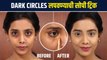 Dark Circles लपवा अगदी सोप्या पद्धतीने | Easy Trick to Hide Dark Circles | How To Hide Dark Circles