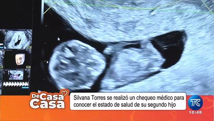 Silvana Torres se realizó la ecografía de su segundo bebé