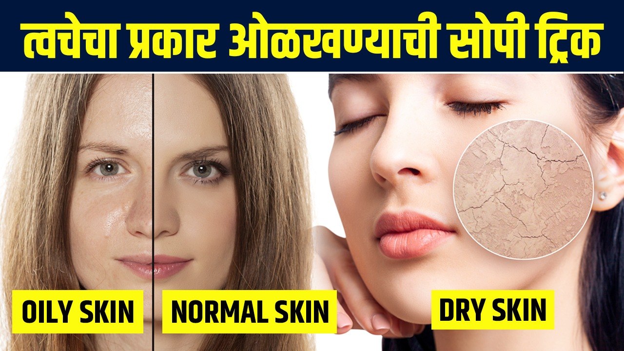 स्वतःची Skin Type कशी ओळखायची? | How to Determine Your Skin Type | Know Your Skin Type | MA