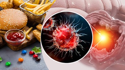 Ultra Processed Food क्या होता है | अल्ट्रा प्रोसेस्ड फ़ूड कैसे बनता है | Boldsky