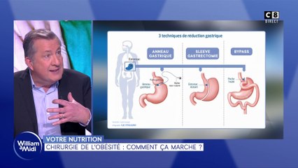 Votre nutrition : Chirurgie de l'obésité : comment ça marche ?