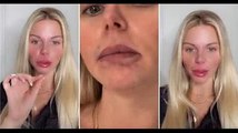 Jessica Thivenin  J’ai du mal à ouvrir les yeux , elle se confie après sa dernière chirurgie esthé