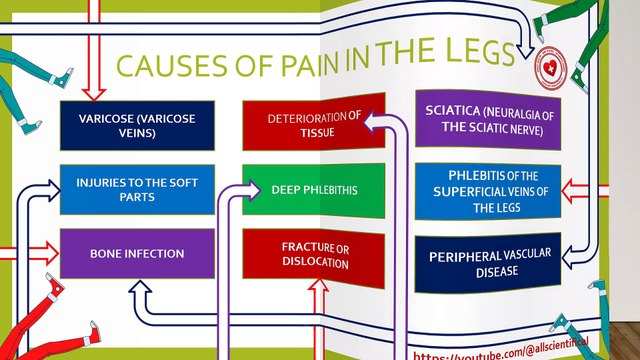 Why do my legs hurt? 9 causes of this problem and how to fix them?
