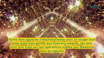 Madonna méconnaissable : l'avis d'un chirurgien esthétique