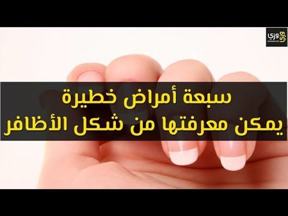 أهم سبعة أمراض خطيرة يمكن معرفتها من شكل الأظافر