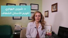 التقويم الشفاف ميزاته وعيوبه
