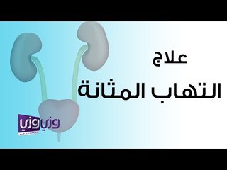 علاج التهاب المثانة