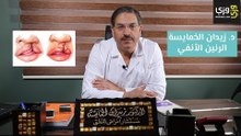 الخنة النطقية أو الرنين الأنفي أسبابها وطريقة العلاج