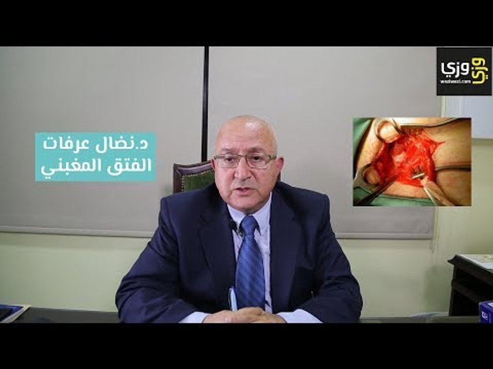 الفتق الإربي (الفتق المغبني) وطريقة علاجه