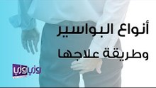 أنواع البواسير وطرق علاجها