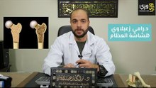 أسباب وأعراض هشاشة العظام وكيفية علاجها
